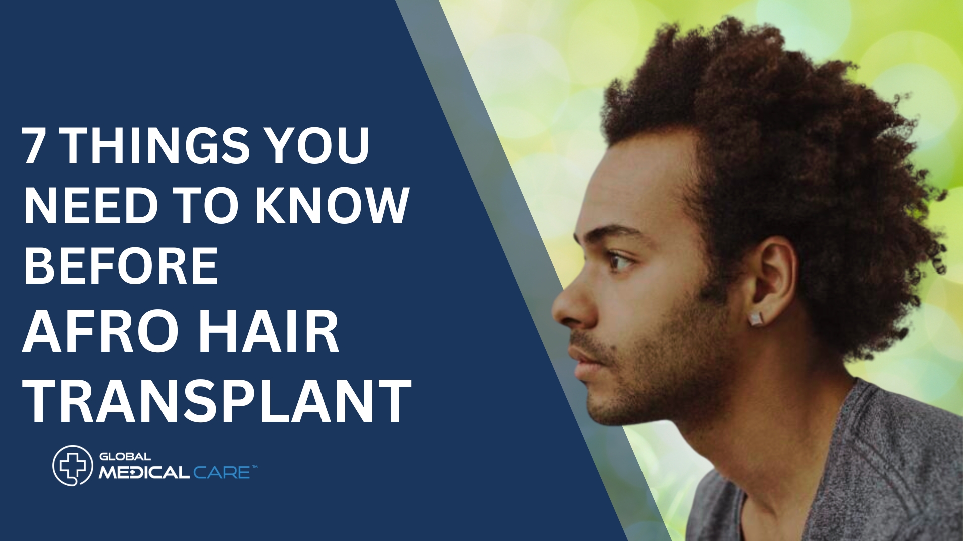 Things You Need To Know Before afro hair Transplant