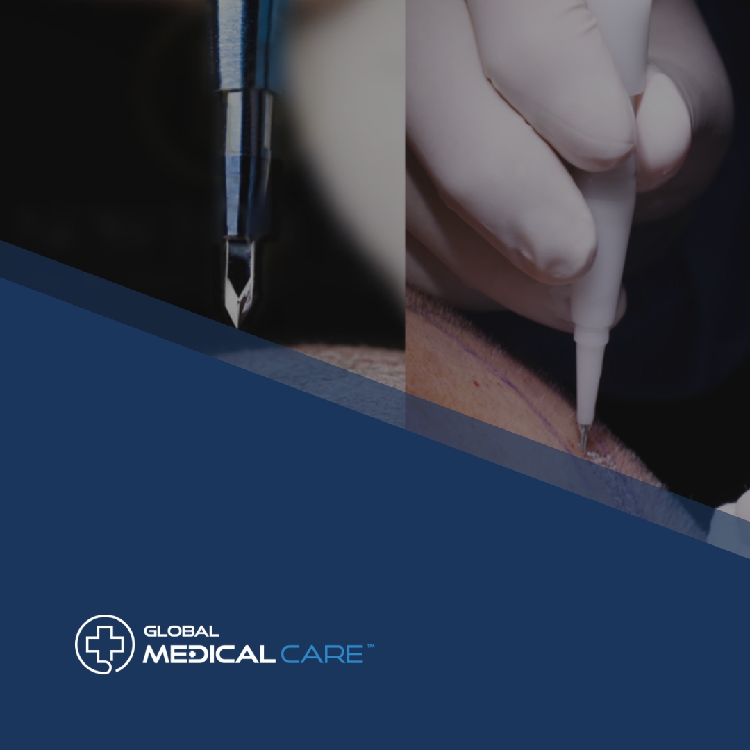 fue vs dhi afro hair transplant