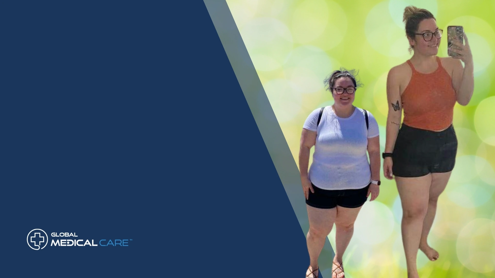 Gastric Bypass surgery in turkey