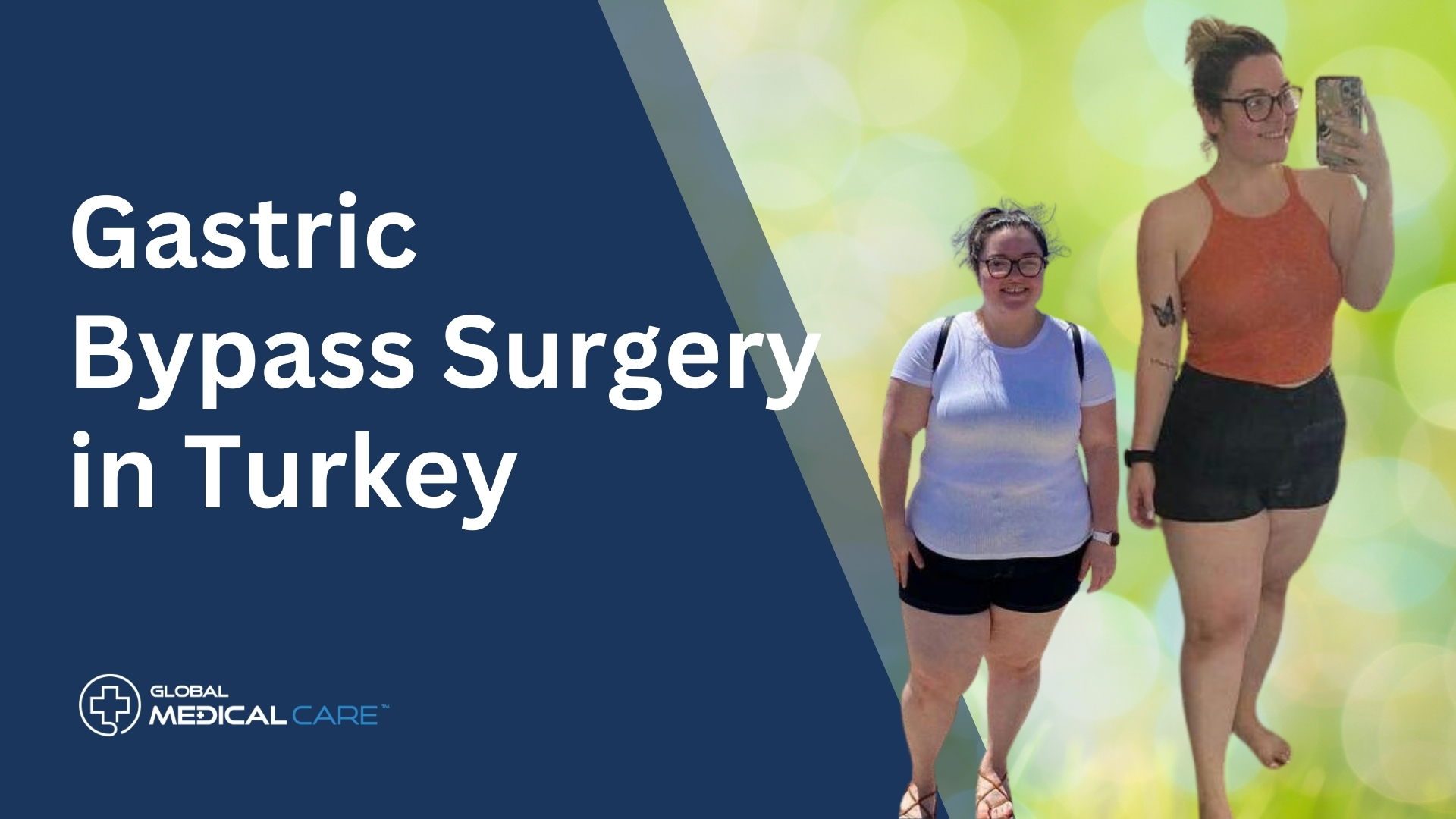 Gastric Bypass surgery in turkey