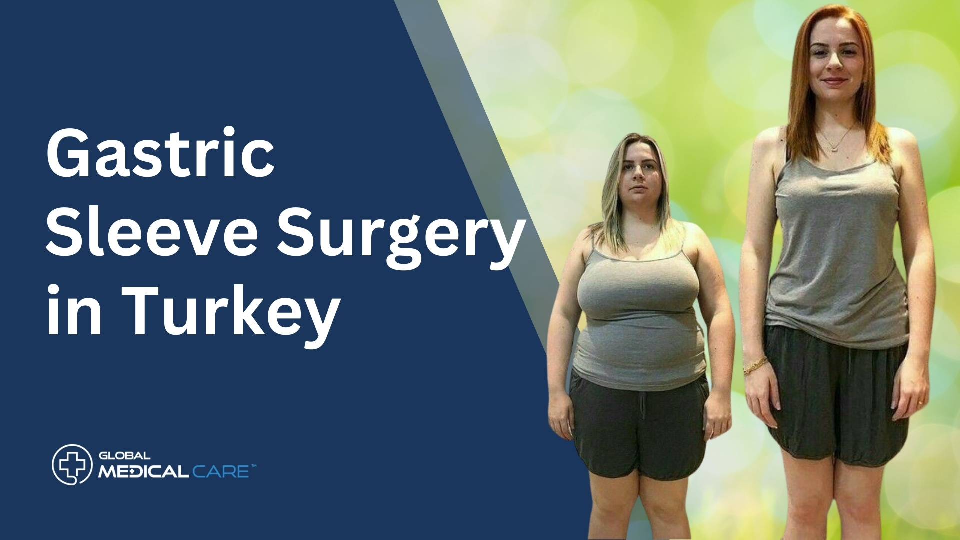 obesity surgery turkey
