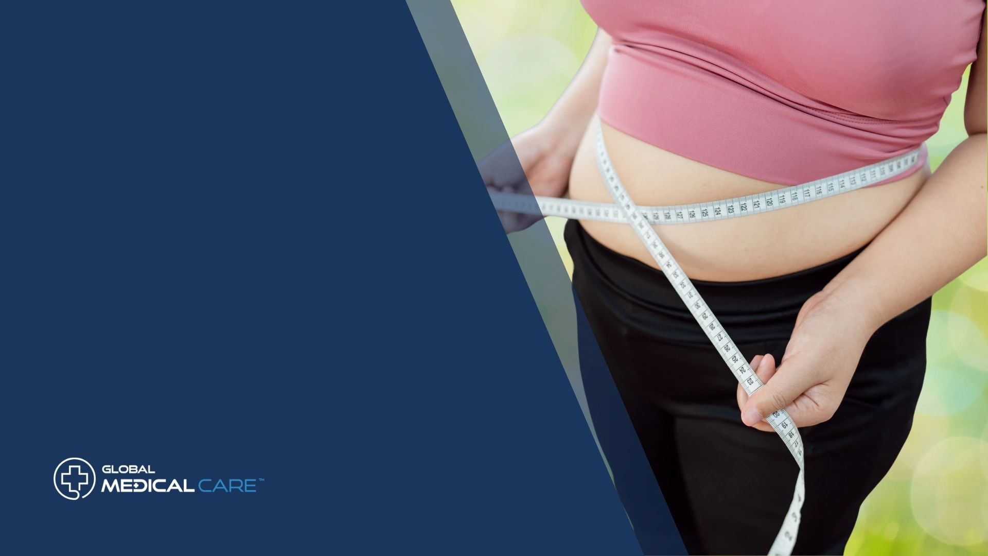 obesity surgery in turkey