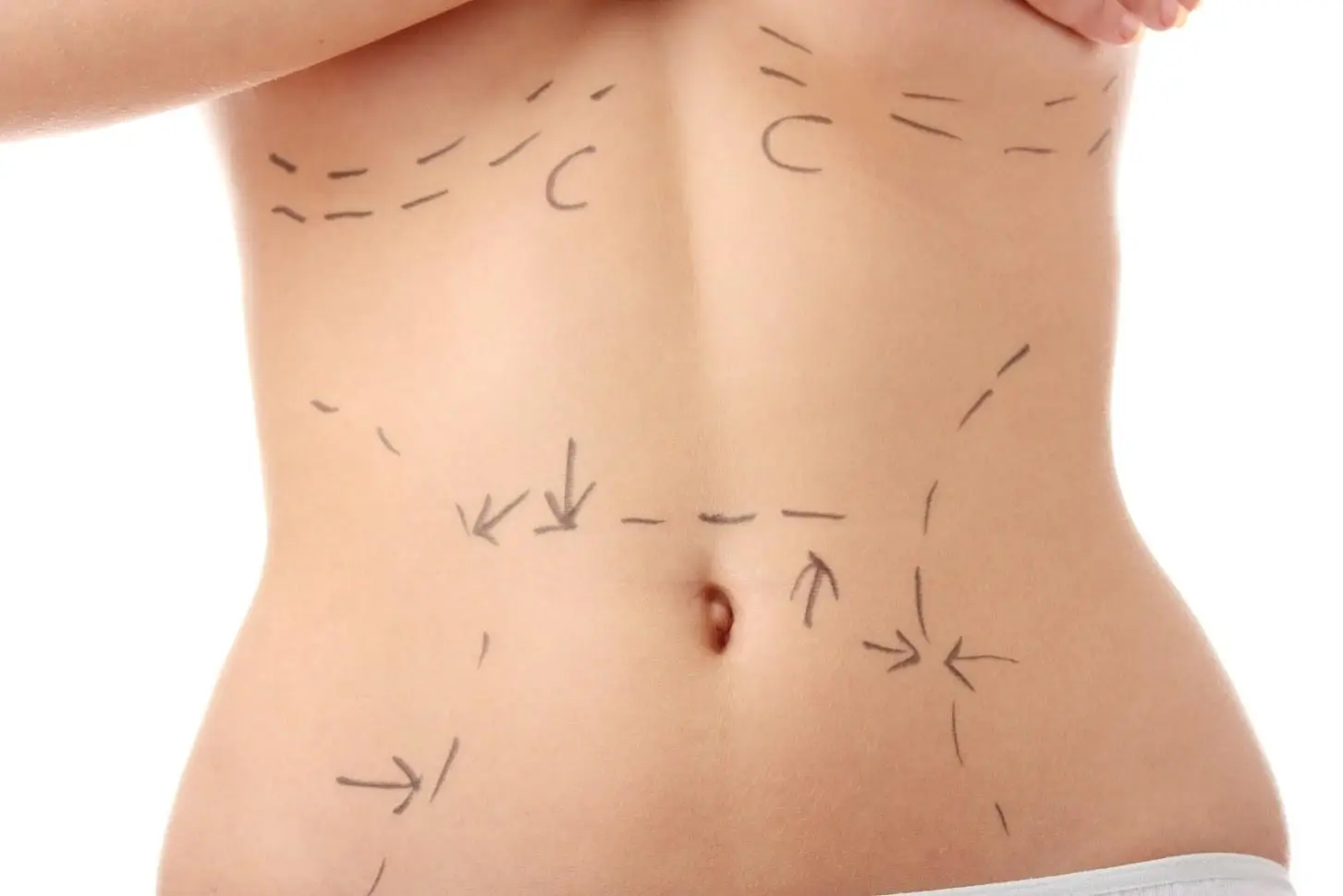Mummy Makeover Surgery Recovery