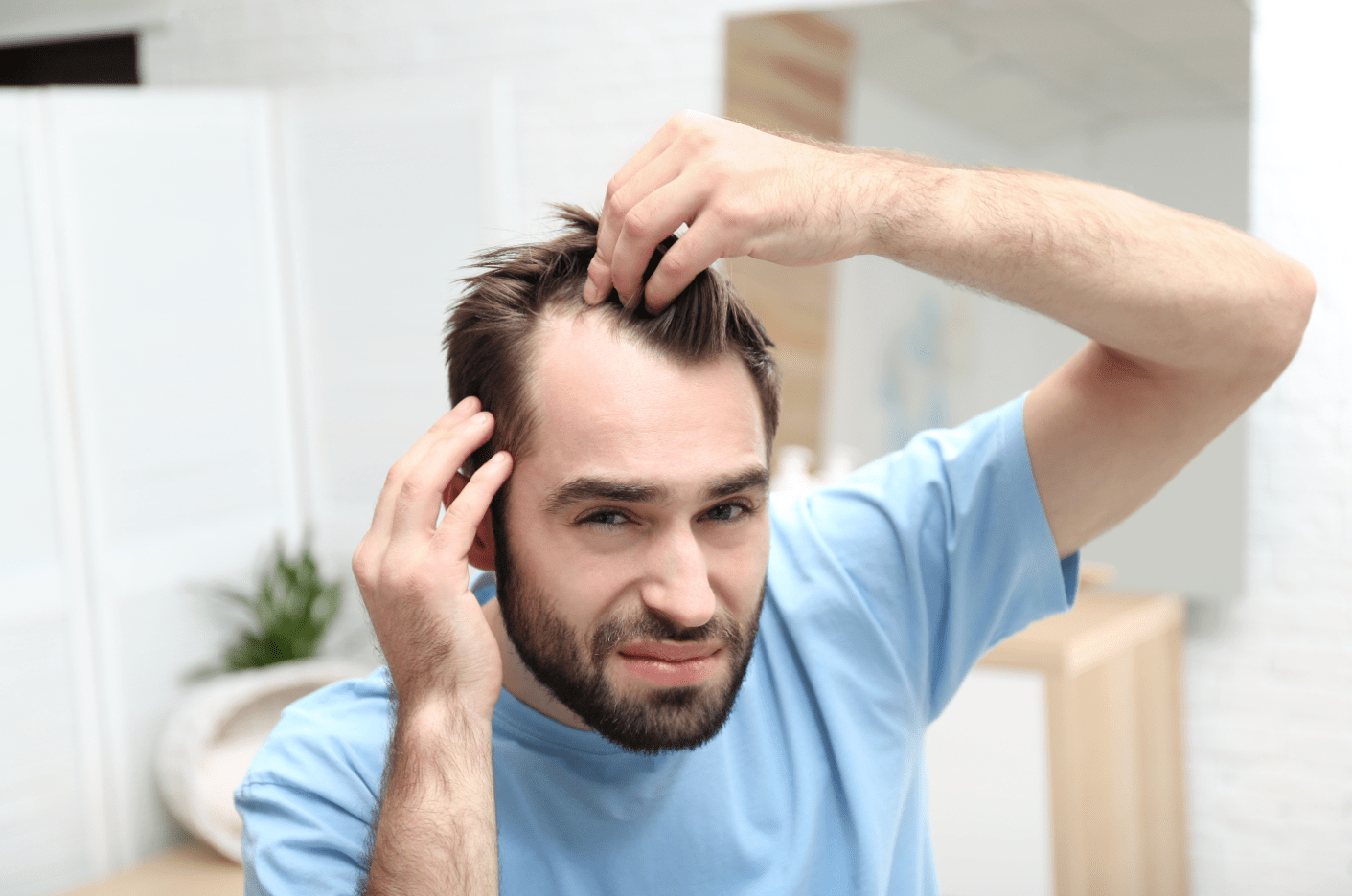 Hair transplant for receding hairline