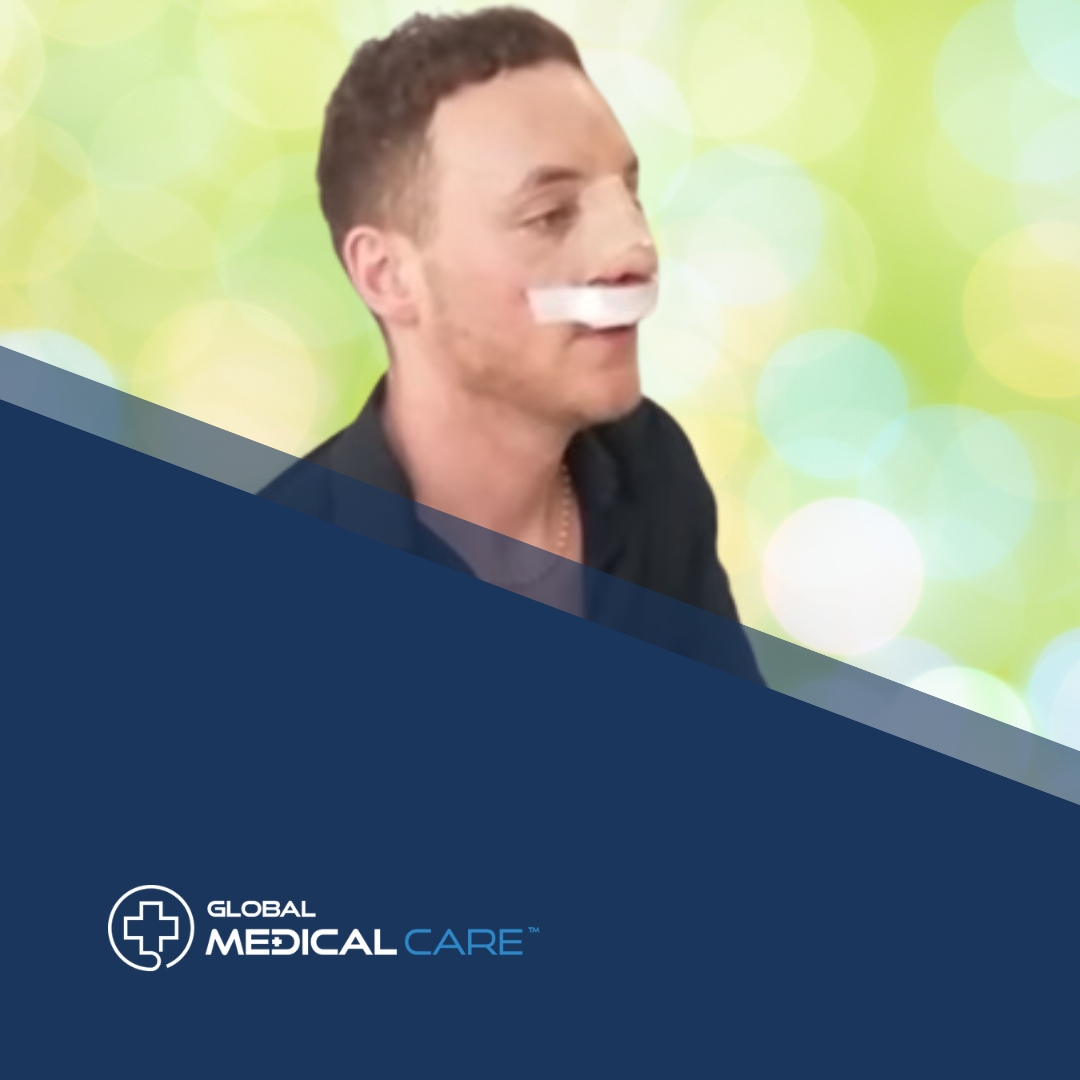 Rhinoplasty surgery in turkey review