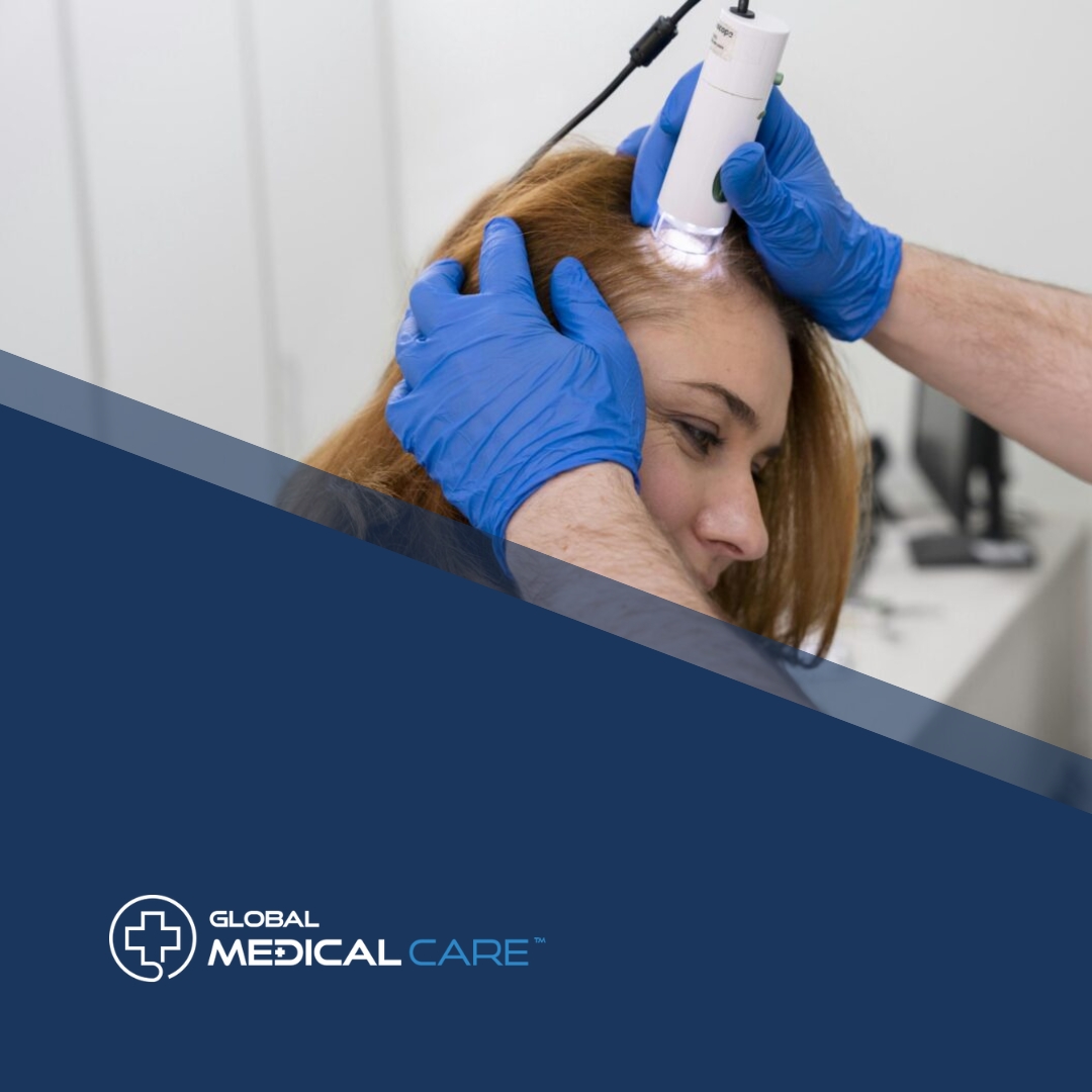 woman hair transplant turkey