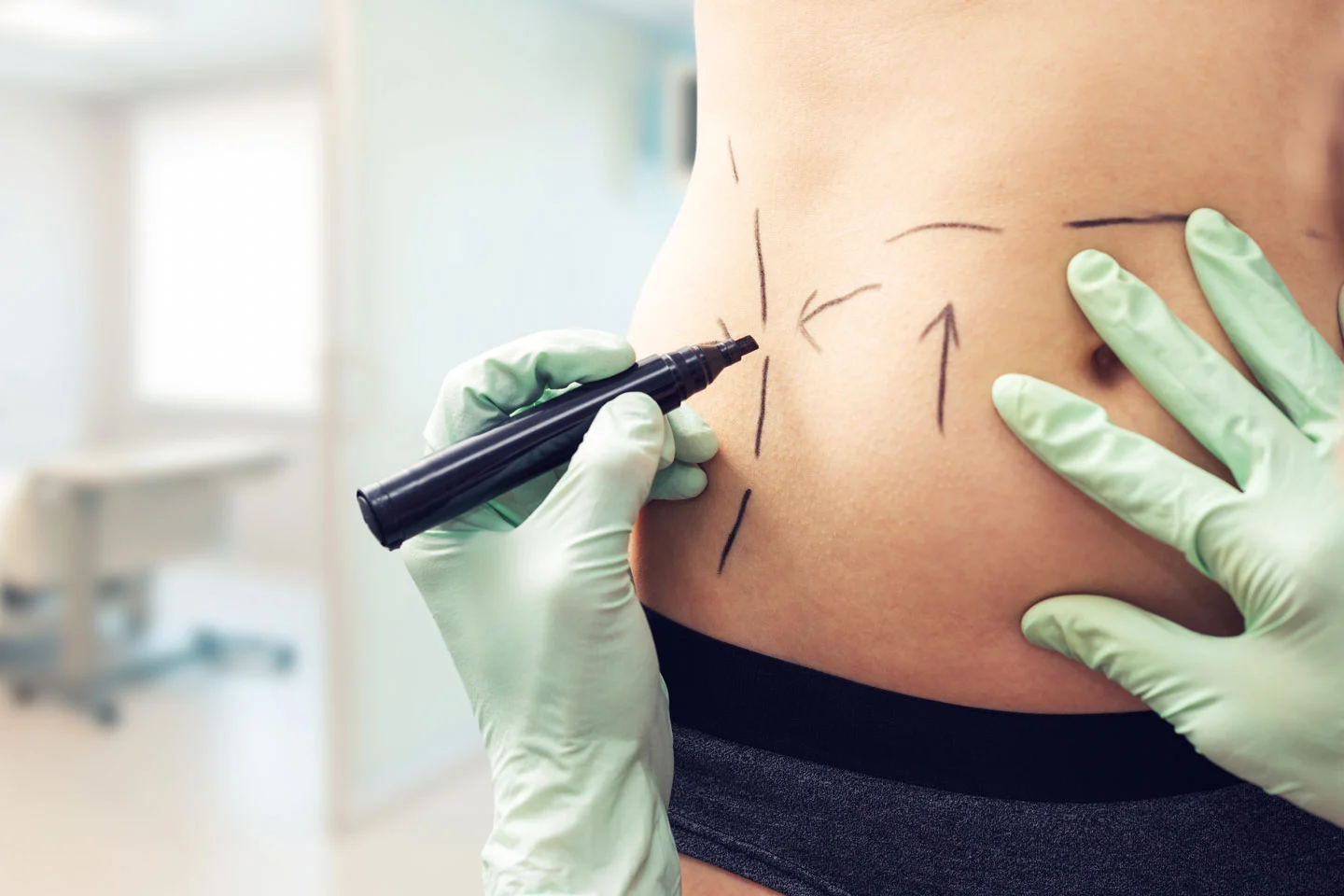 How painful is abdominoplasty
