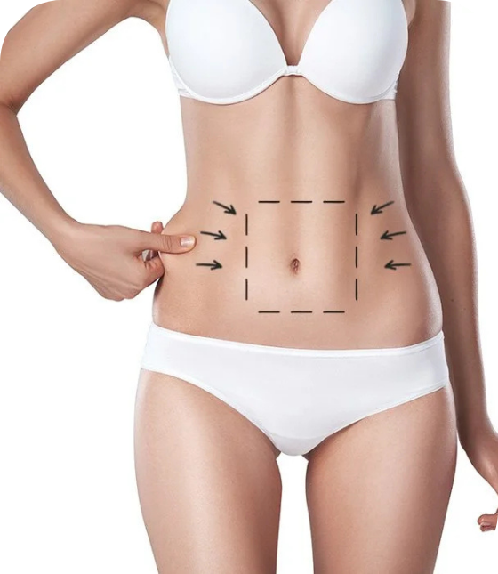 abdominoplasty surgery turkey