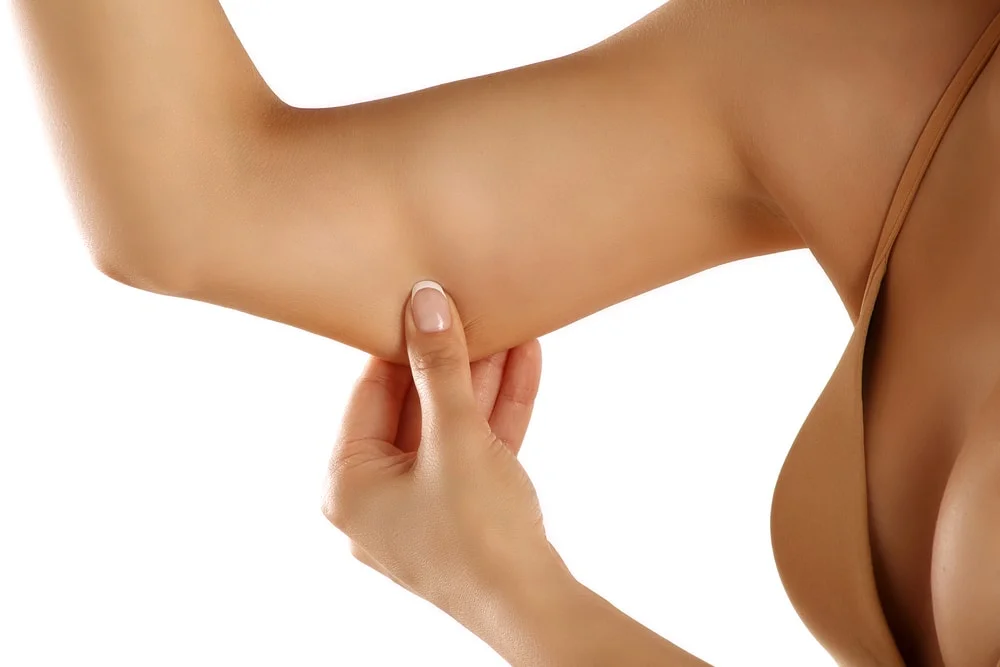 Can an arm lift be performed without surgery?