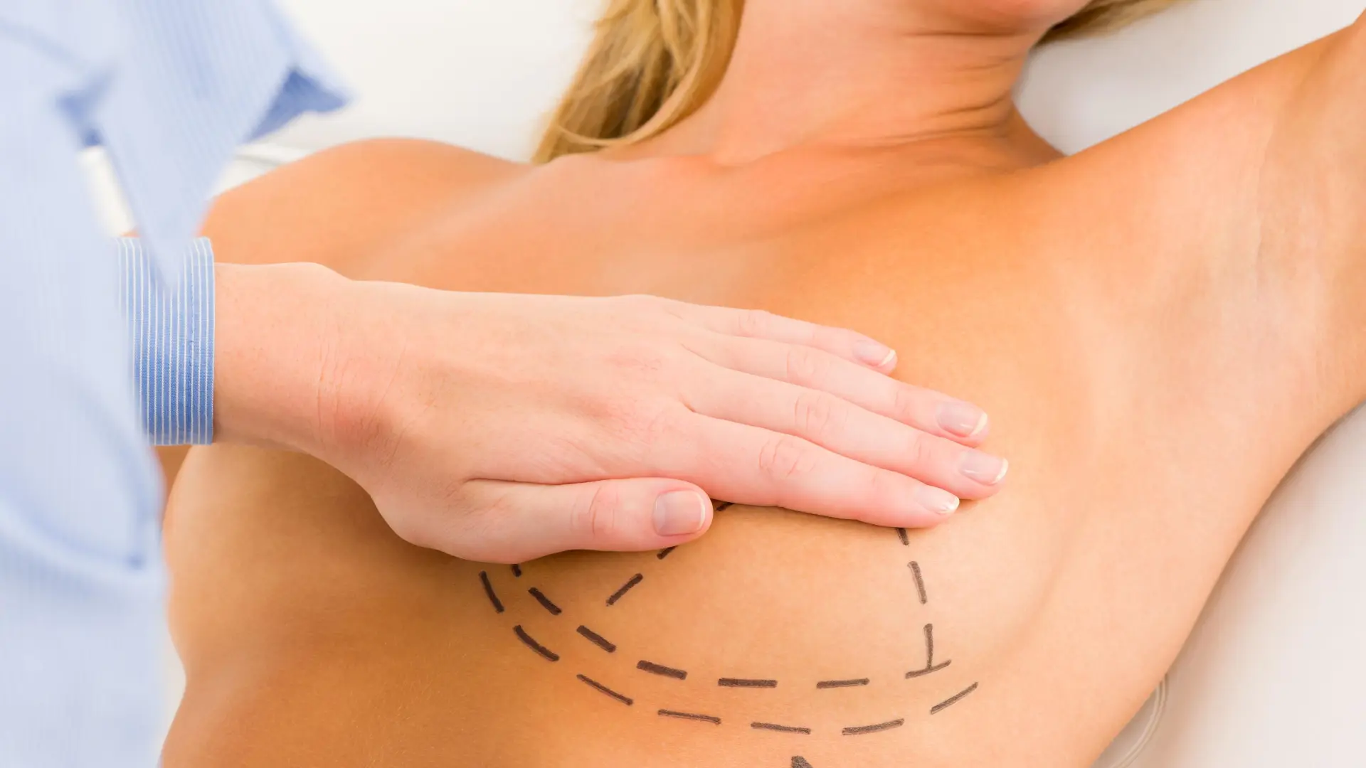 Risks of breast lift