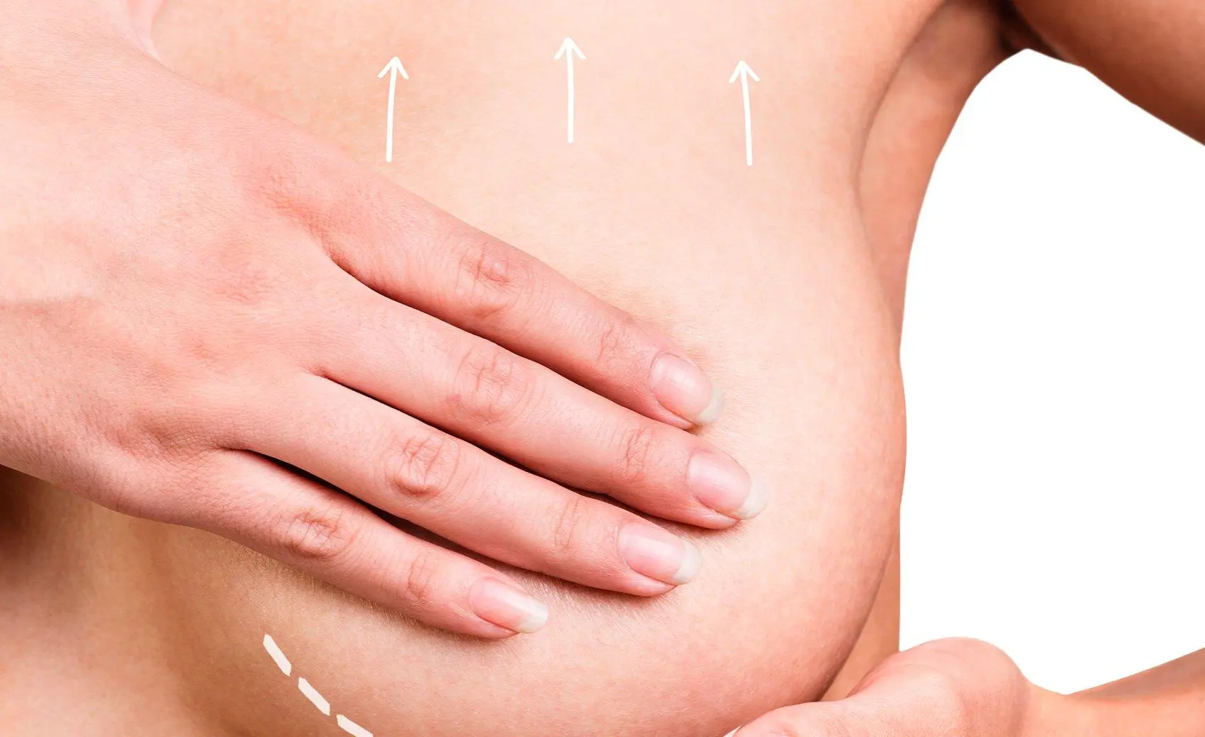 Breast lift recovery