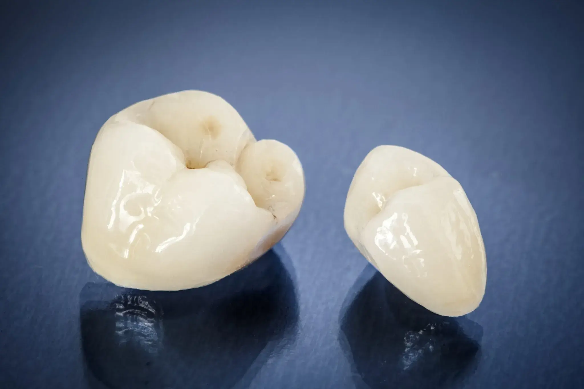 Zirconia and Emax crowns