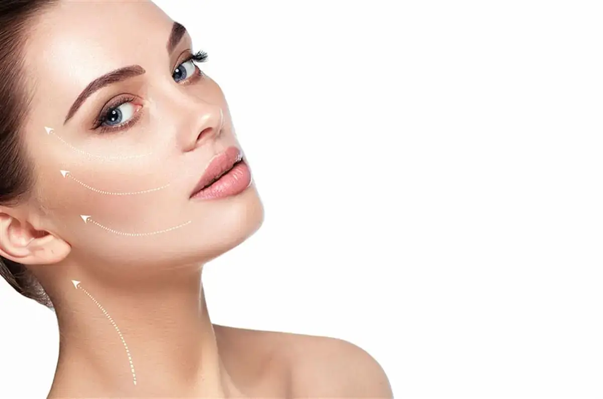 Recovery after facelift surgery