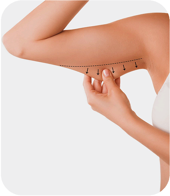 arm lifting surgery turkey