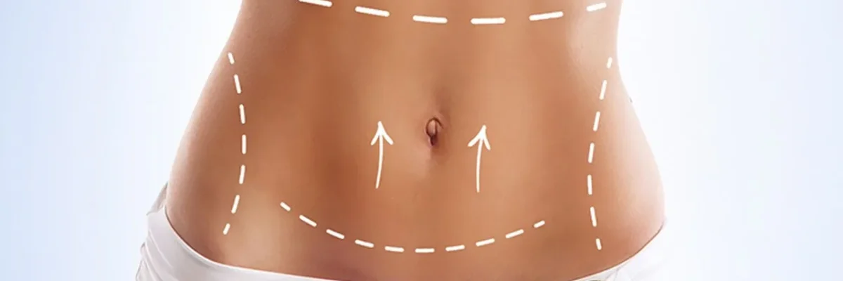 L'abdominoplastie et la plastie abdominale