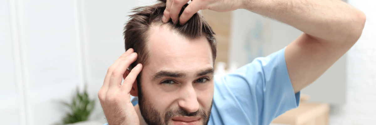 Hair transplant for receding hairline