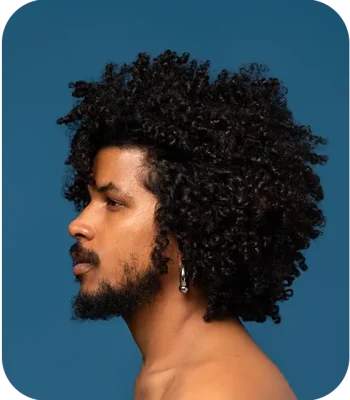 afro hair transplant turkey