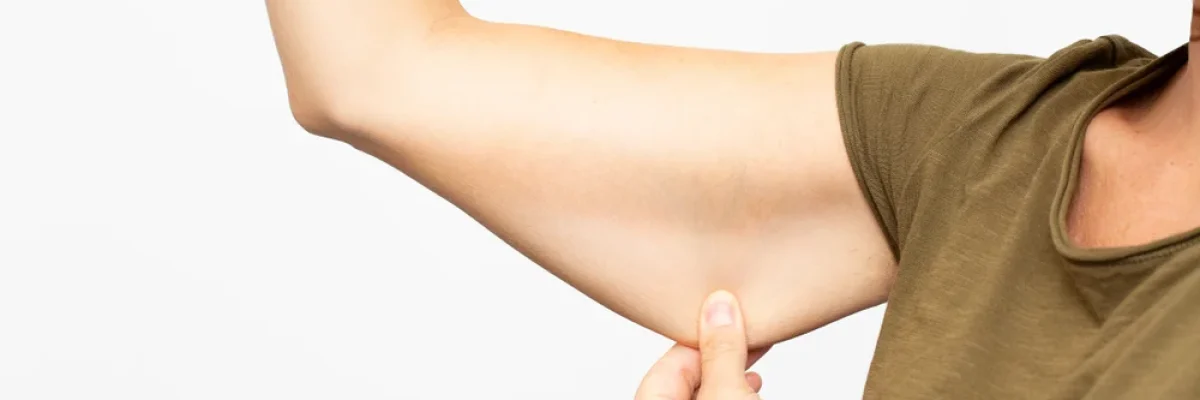 can-arm-lift-be-done-without-surgery