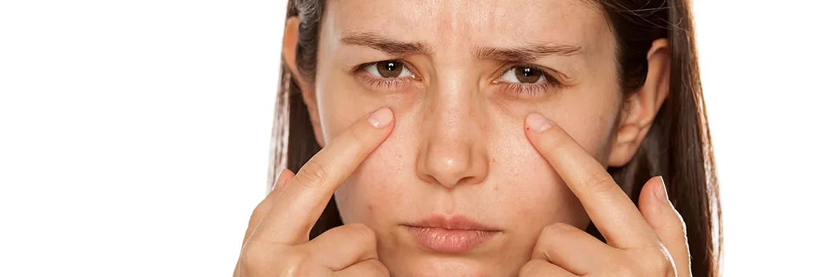 Dark undereye bags are a common concern that can make you appear tired, older, and less vibrant and affect your overall confidence.