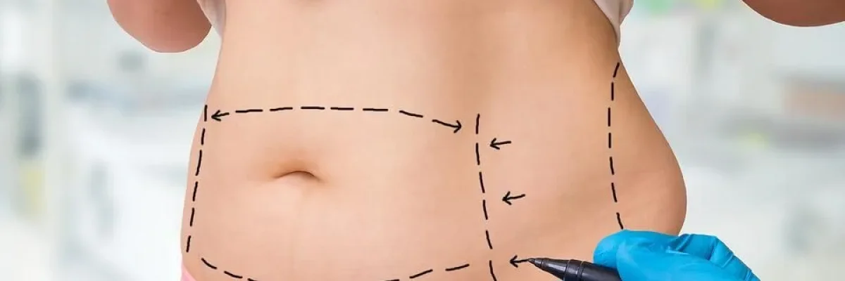 Gastric Sleeve Surgery UK Price