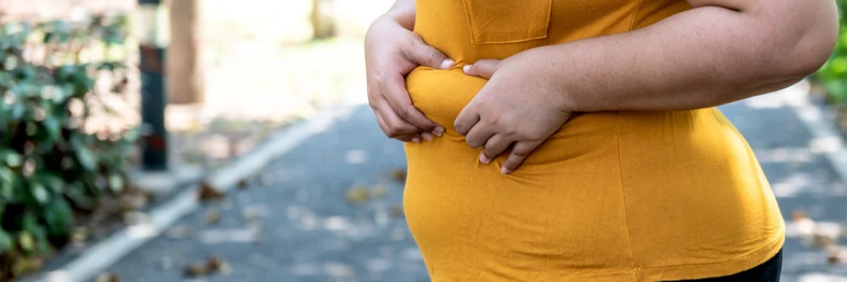 What is Considered Obese in the UK?