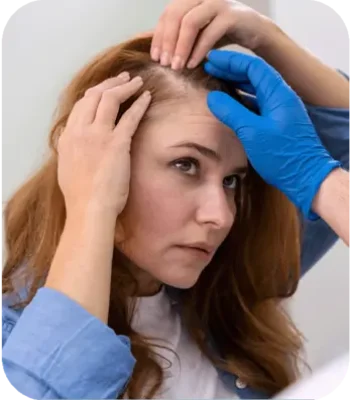woman hair transplant turkey