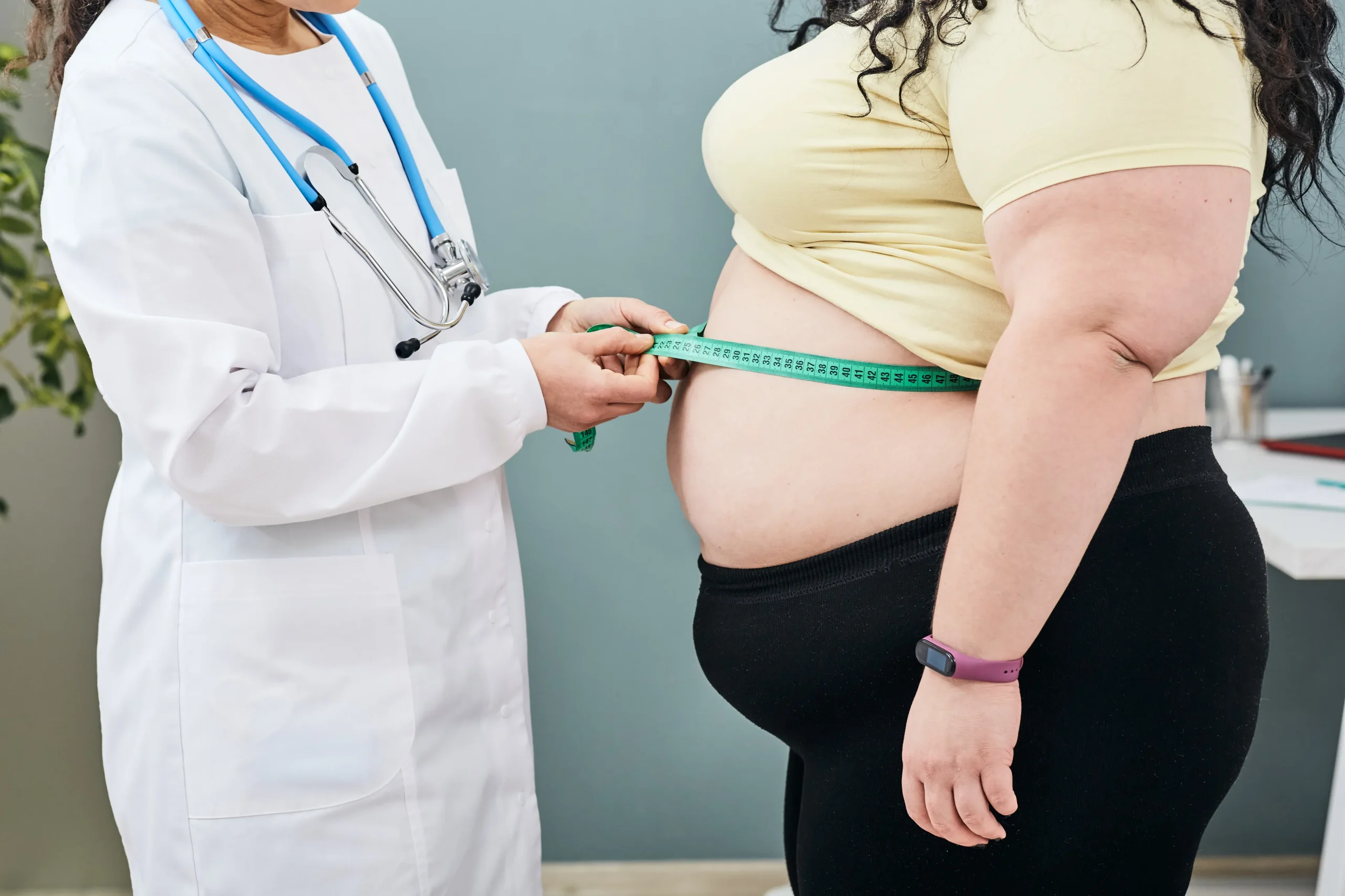gastric-sleeve
