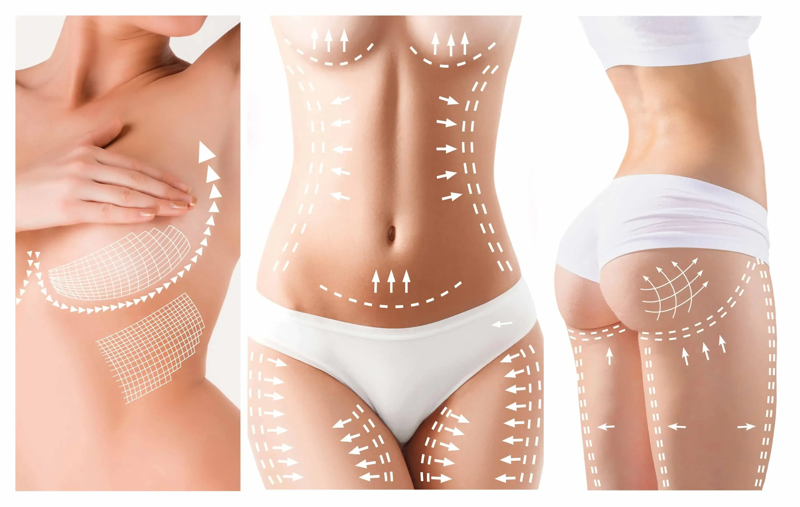 The Mummy Makeover Procedure