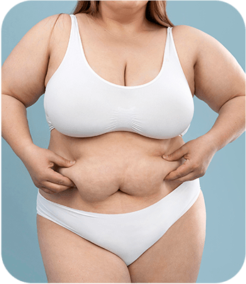 obesity surgery in turkey