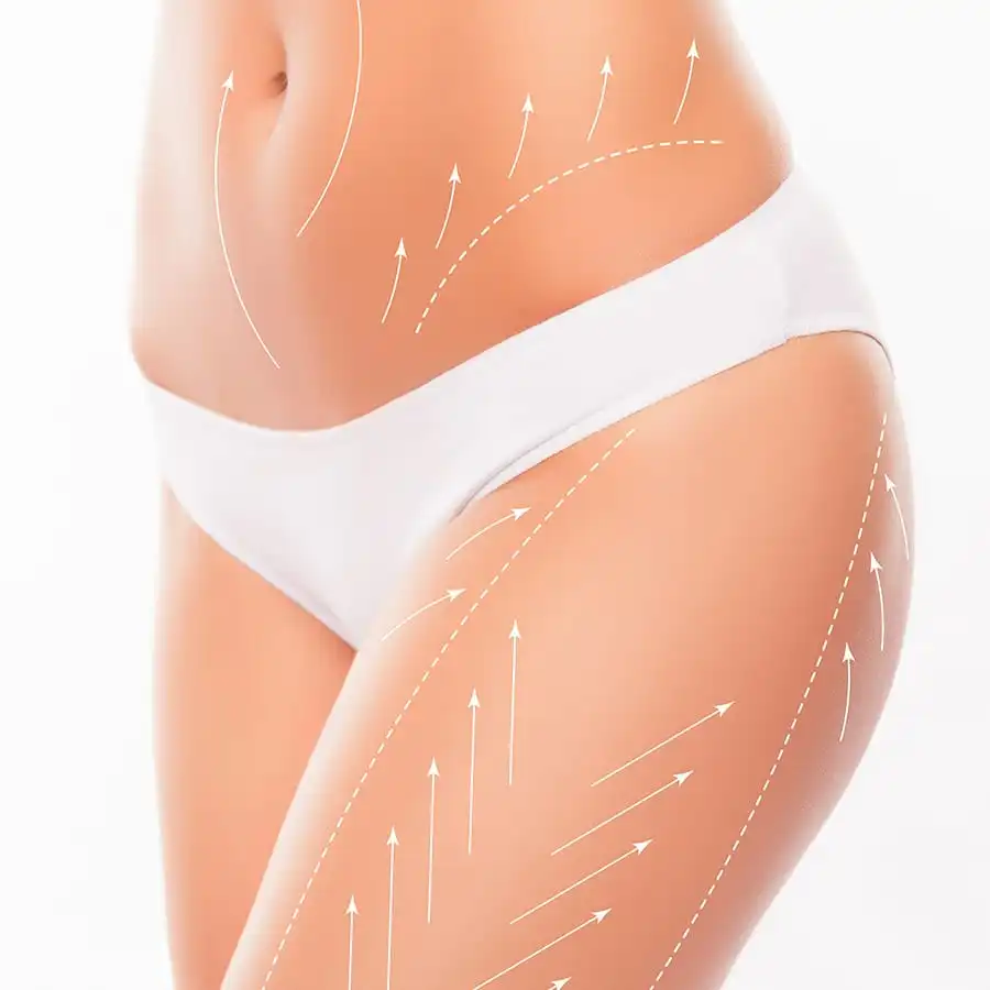 thigh lift surgery turkey