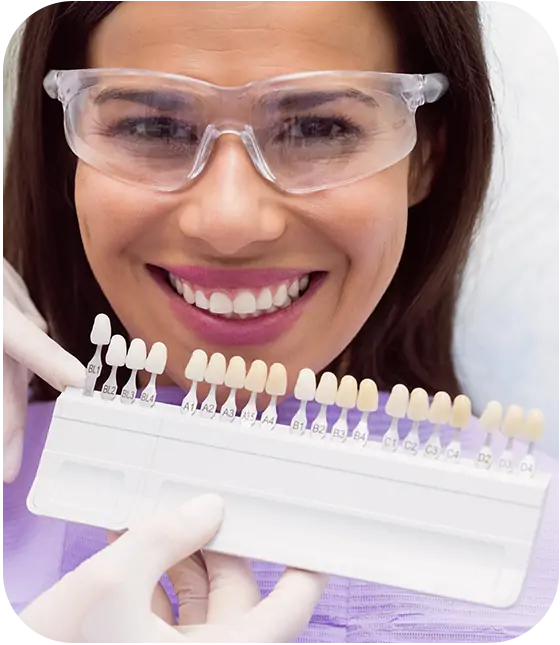 dental veneers