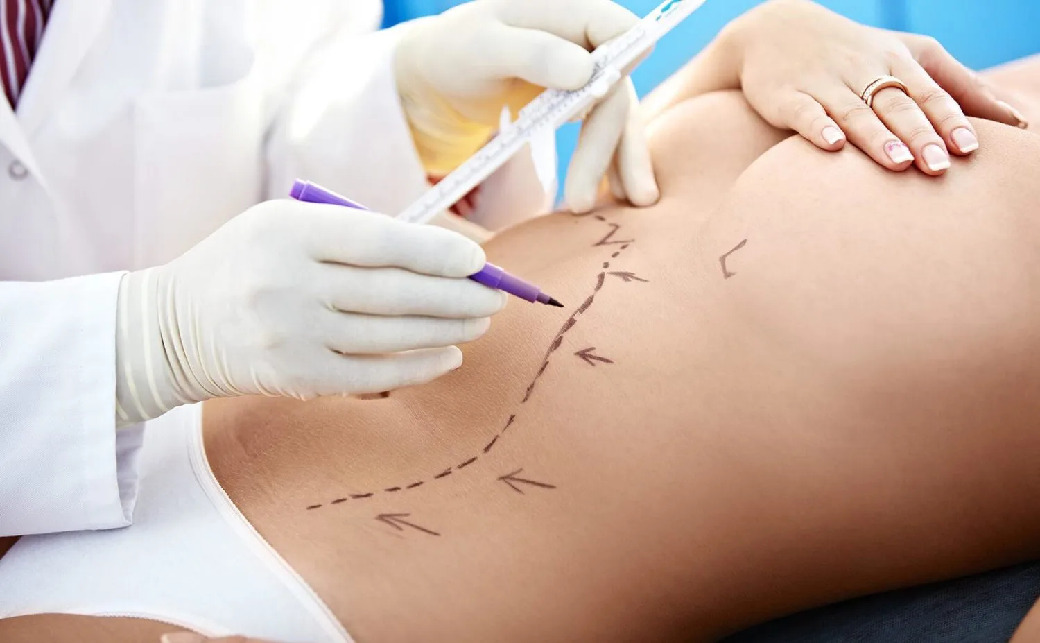 What Types of Abdominal surgery Are there?