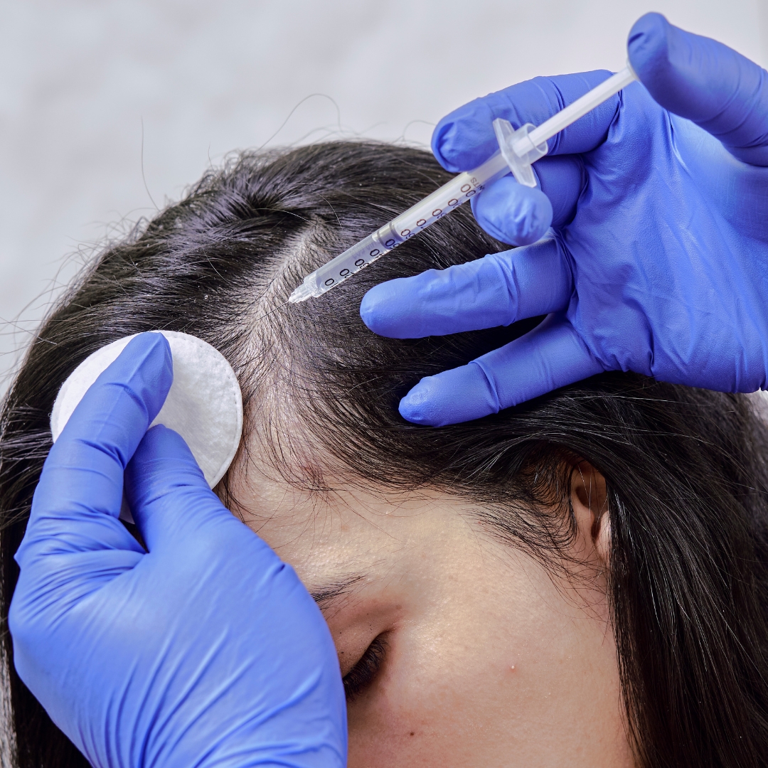 woman hair transplant surgery